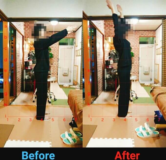 結婚式を1週間後に控え、どうしても慢性肩こりのハリとデコルテが気になり整体でも行っておこうかくらいの気持ちでいました。施術前に自分の身体をチェック！猫背だね〜骨盤歪んでるね〜と自覚のなかった私は半信半疑でしたが、先生に言われるまま身体を動かしてみるとまったくその通りであちこちが歪んでいるのをこの目で確かめプチショックでした笑あんな短時間で的確に当ててくる先生はエスパーなんじゃないかと思いました。整体＝痛みを我慢しながら耐える…と思っていたので、心地いい施術にびっくり！すこーしの施術で身体がどんどん軽くなるのがわかるので、なんだこれ！！と施術中ずーっと感じていました。施術後に鏡の前に立つとデコルテは出てるわ、バストアップしてるわ、骨盤締まってるわ、お尻が小さくなってるわ…まるで別人！「姿勢が良くなって帰りに車のミラー直すお客さんもいるみたいだよ〜」と言われ、さすがにいやいやいや〜と思いながら軽くなった身体で車に乗り…ミラーを直しました。笑