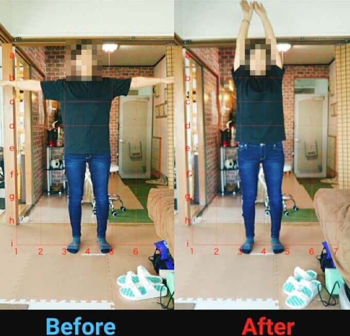 ずーっと肩こりで悩まされてて、接骨院や整形外科、ペインクリニックで注射して痛みを和らげて、だましだまし過ごしてた私ですが、どこの先生に診てもらっても原因がはっきりしなくてモヤモヤしてました。サプライズ整体に行って原因を知り、先生の説明がわかりやすく治さなければいけないところを触りながら施術してもらえました(^^)産後の腰痛も1回の施術で楽になりました♪腰回りがスッキリしました☺︎すぐ2回目したかったのですが、予約がいっぱいな為1ヶ月後に予約しました!!すぐに行きたいですがまた少し待って治してもらいます(*^^*)予約が取りにくい理由が分かりました(´ε｀ )1度目は2980円で色々調べてくれるのでオススメです☺︎