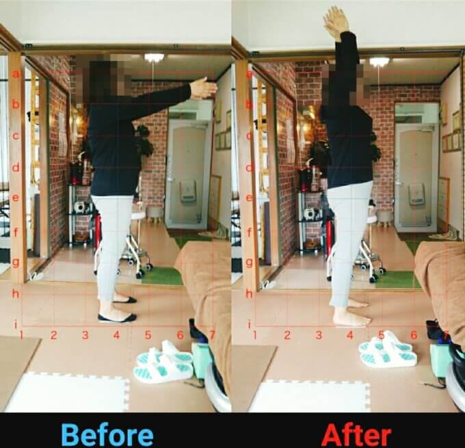 肩こりと体のゆがみが改善されたビフォーアフター画像