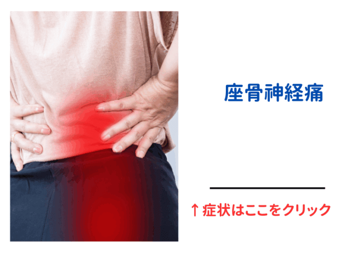 座骨神経痛のメカニズムと解説