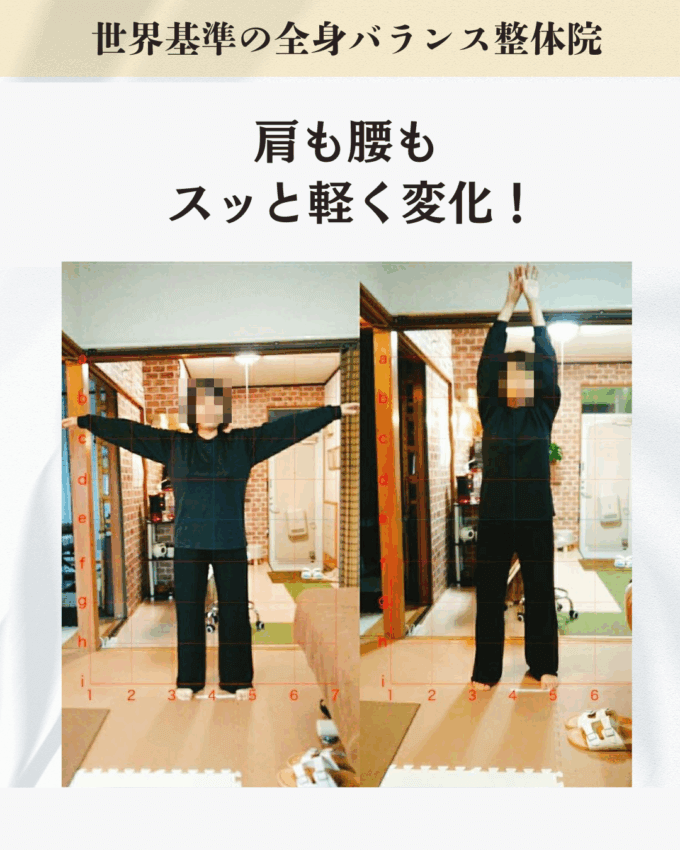 「座り仕事で気付いたら肩が丸まる癖がついていました。セルフケアもやってみましたが、なかなか変わらず困っていたお客様のビフォーアフター