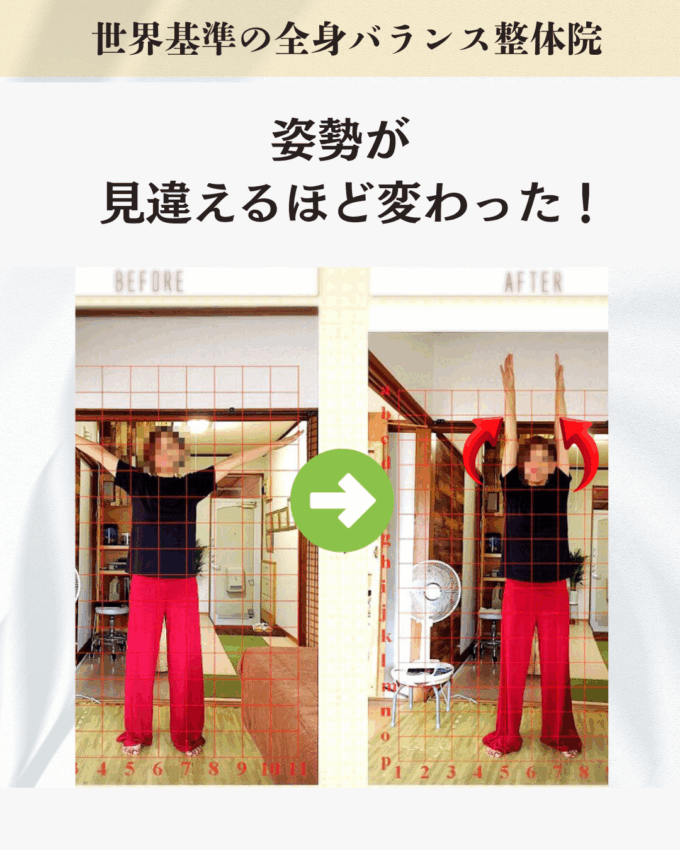 長時間のスマホ利用で首・頭痛が慢性化で悩むお客さまのビフォーアフター