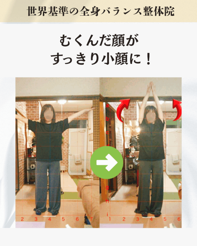 「小顔になりたい」「顔のむくみが気になる」「肩こりが気になる」というお客様のビフォーアフター