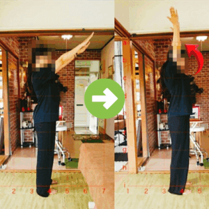 肩こり腰痛のお客様のビフォーアフター画像のご案内