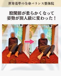 反り腰を本気で改善したいと思っているお客様のビフォーアフター