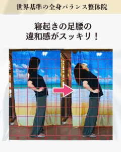 寝起きの足・腰の痛みを抱えているお客様のビフォーアフター