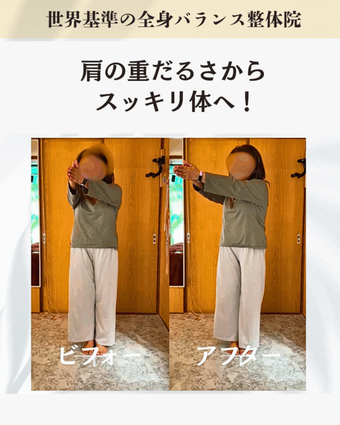 肩や膝に引っかかるような違和感を訴えていたお客様のビフォーアフター