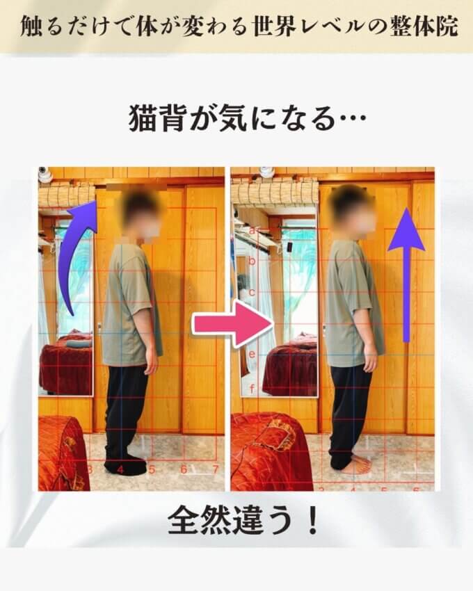 猫背がきになるお客様のビフォーアフター