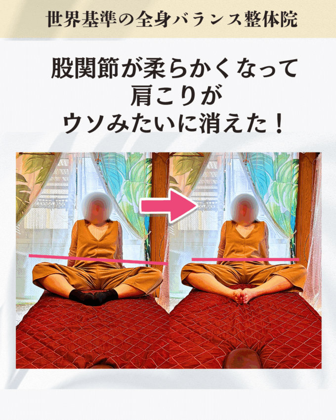 デスクワークで慢性的な肩こりに悩むお客様のビフォーアフター