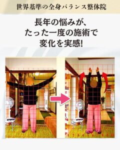 デスクワークで首や肩がつらくて仕方ないお客様のビフォーアフター