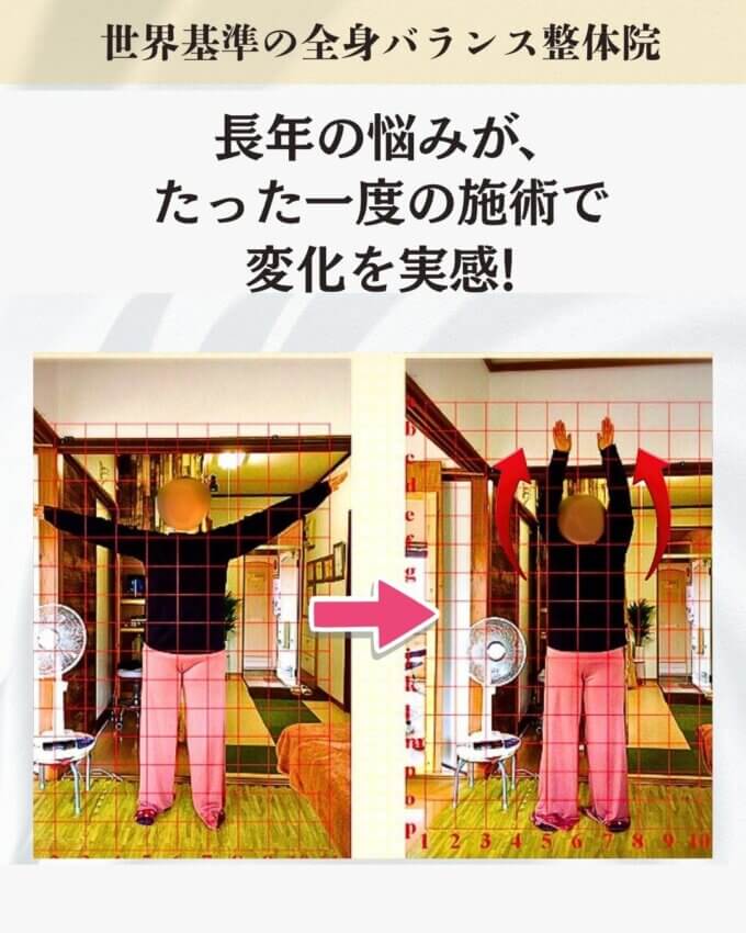 デスクワークで首や肩がつらくて仕方ないお客様のビフォーアフター