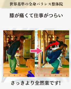 膝の痛みでお悩みのお客様のビフォーアフター