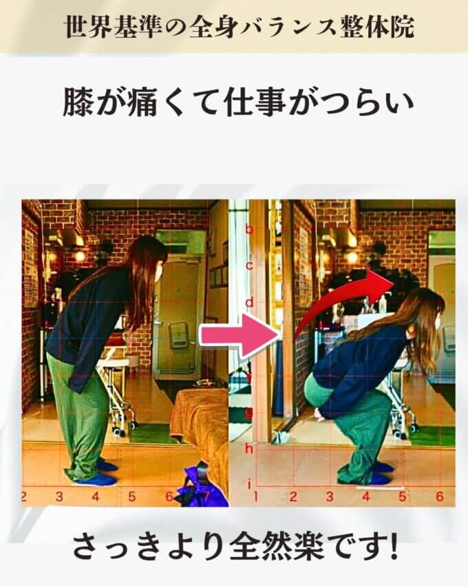 膝の痛みでお悩みのお客様のビフォーアフター