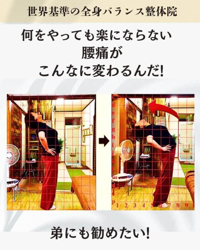 腰が痛くて、スボンを履くのもつらいお客様のビフォーアウター画像