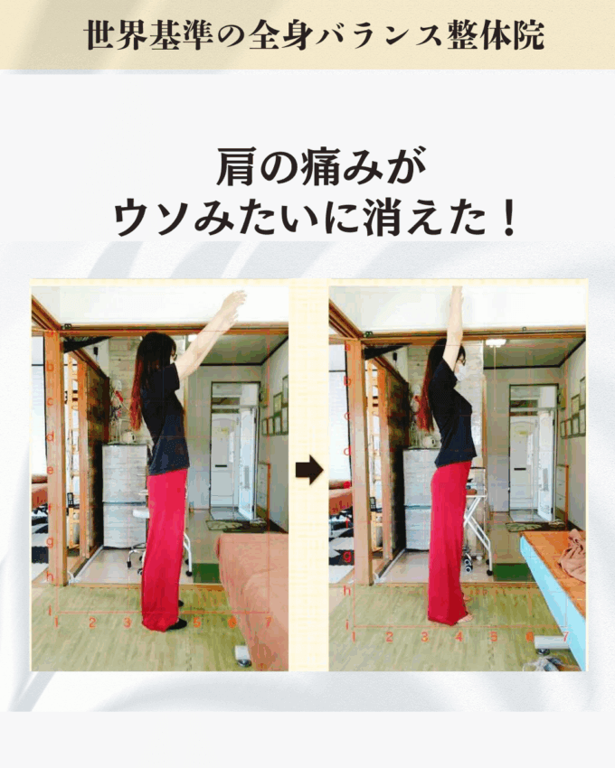 デスクワークを続ける中で、3日から4日経つと痛みが出始め、1週間後には我慢できないレベルになって困っているお客様のビフォーアフター