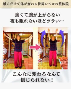 肩こりがひどく夜も眠れないくらいツラいお客様のビフォーアフター