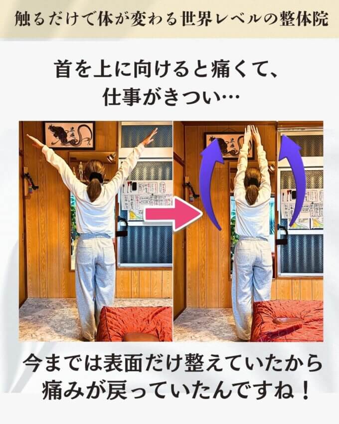 首と股関節の痛みで悩むお客様のビフォーアフター画像