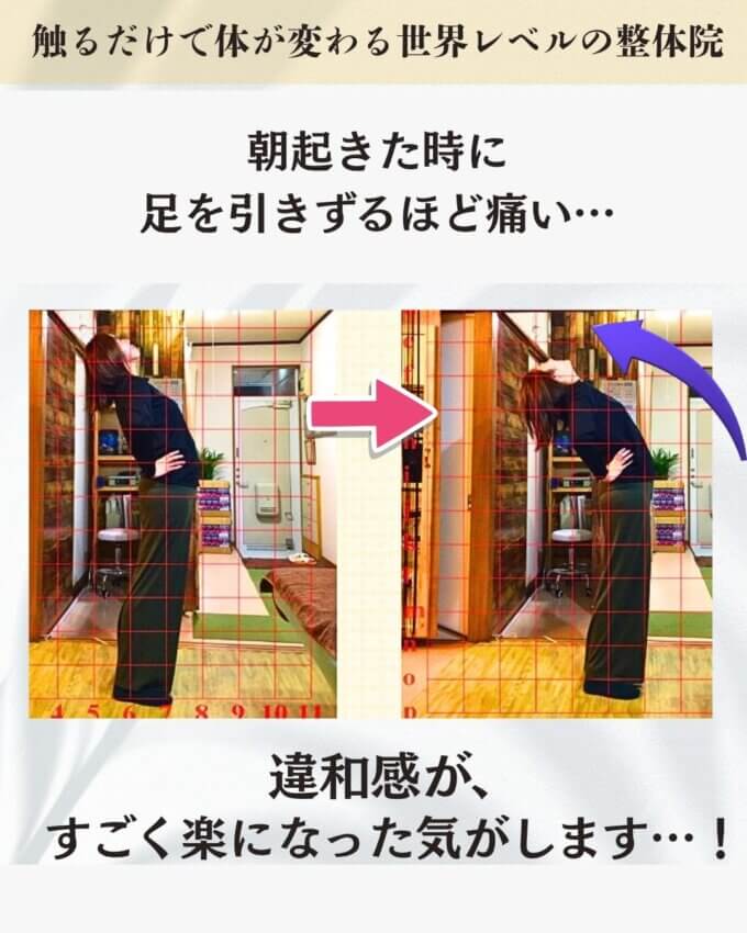 朝起きた時に足を引きづるほど腰が痛いお客様の4ビフォーアフター