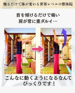 肩と首が痛いお客様のビフォーアフター画像