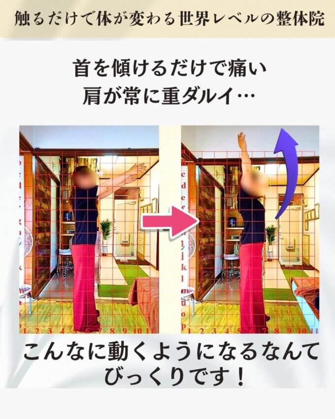 肩と首が痛いお客様のビフォーアフター画像